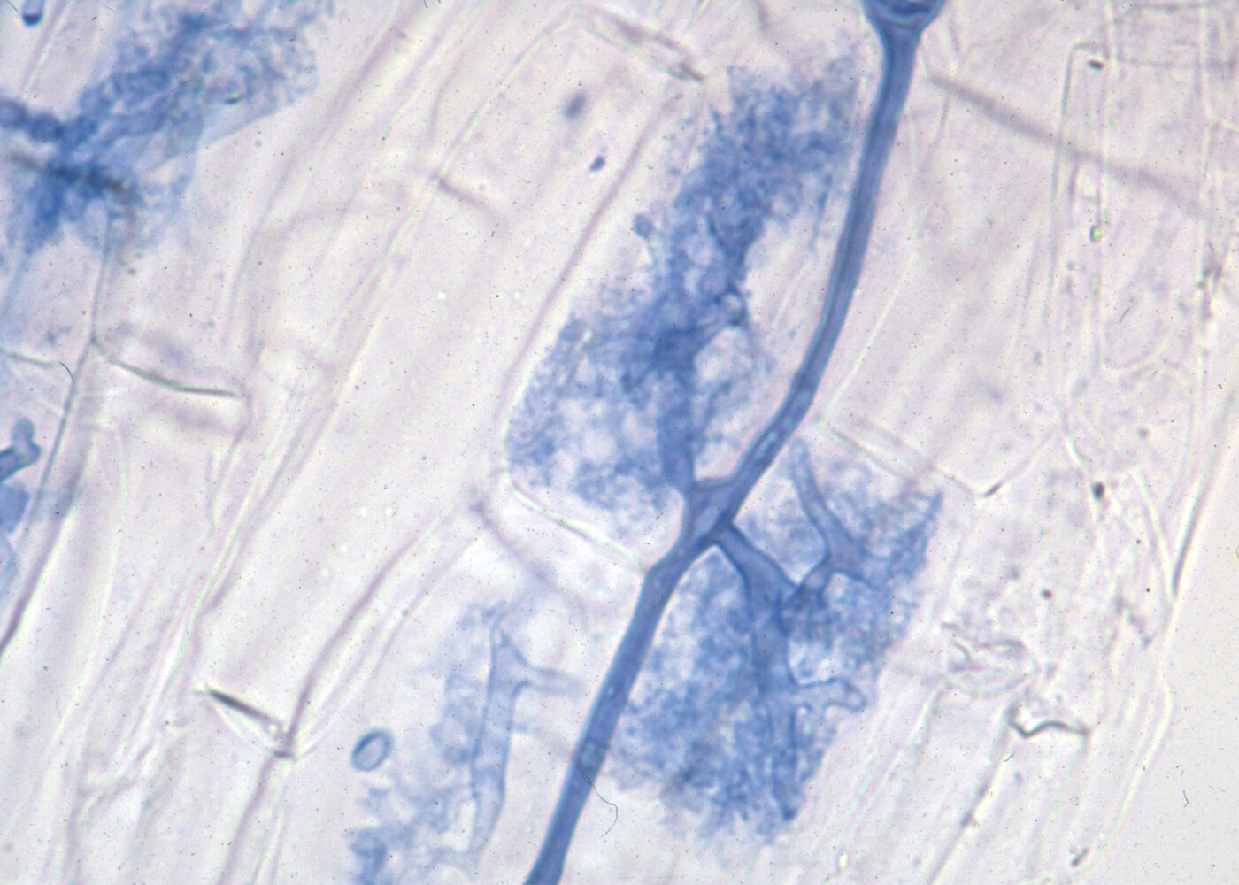 Mykorrhiza i landbruksjord