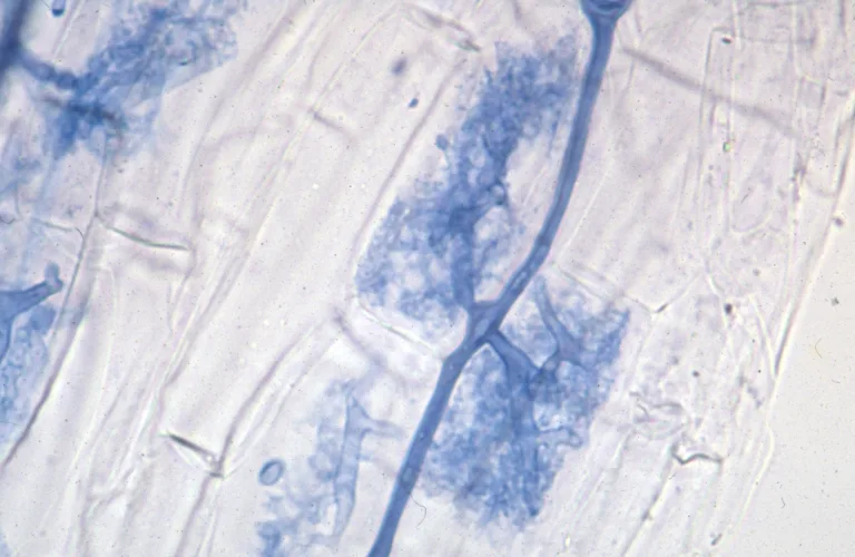Mykorrhiza i landbruksjord