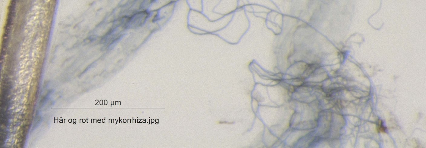SYMBIOSE: De flokete tynne trådene er sopphyfer som har vokst sammen med en tykkere planterot. Helt til venstre i bildet sees et menneskehår. Foto: Anne de Boer og Reidun Pommeresche