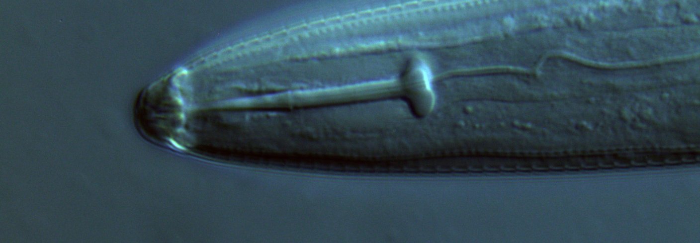 De planteparasittære nematodene har kraftig munnbrodd, her i munnhulen hos en spiralnematode. Foto: Christer Magnusson