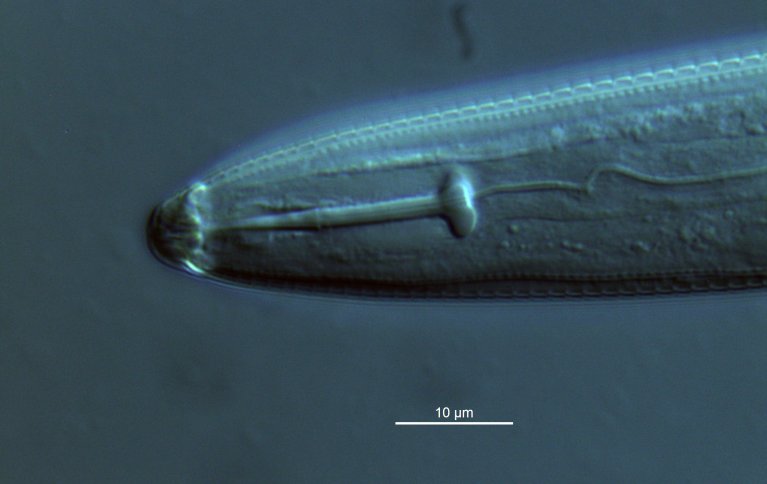 De planteparasittære nematodene har kraftig munnbrodd, her i munnhulen hos en spiralnematode. Foto: Christer Magnusson