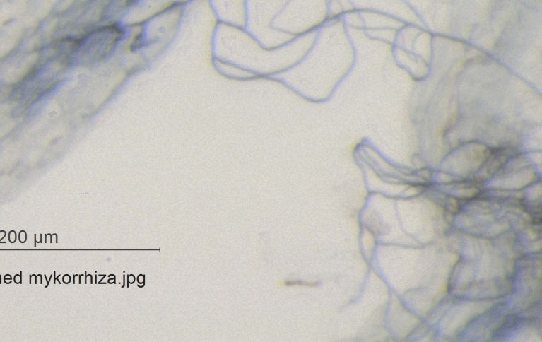 SYMBIOSE: De flokete tynne trådene er sopphyfer som har vokst sammen med en tykkere planterot. Helt til venstre i bildet sees et menneskehår. Foto: Anne de Boer og Reidun Pommeresche