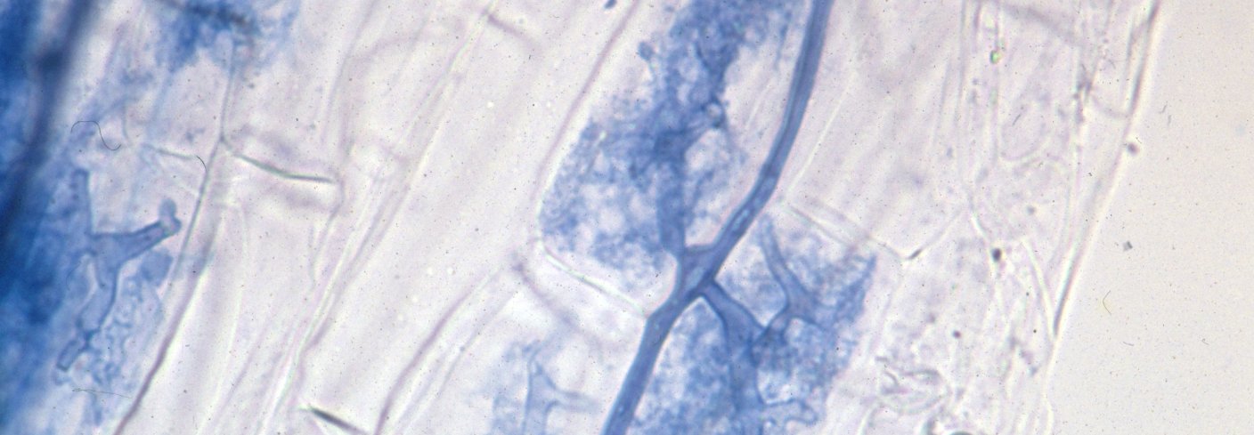 Den mest vanlige typen sopprot er arbuskulær mykorrhiza (AM). Her er soppen farget blå, og arbusklene ses tydelig som sterkt forgrenete strukturerer inne i rotceller hos hvete. Veggene til plantecellene skimtes som blanke firkanter rundt de tre blå arbusklene i bildet. Foto: Theo Ruissen