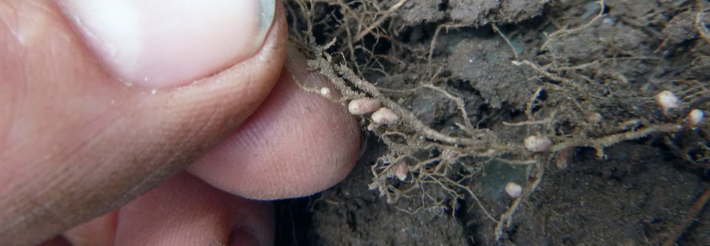 P1040412 Rizobium Rp Biologisk nitrogenfiksering utføres av enkelte mikroorganismer. De mest kjente er bakterier i slekten Rhizobium. . Foto: Reidun Pommeresche